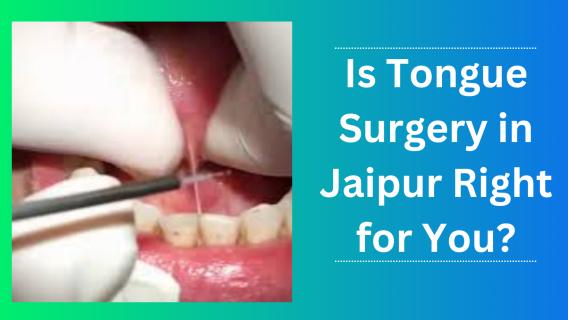 Is Tongue Surgery in Jaipur Right for You? logo