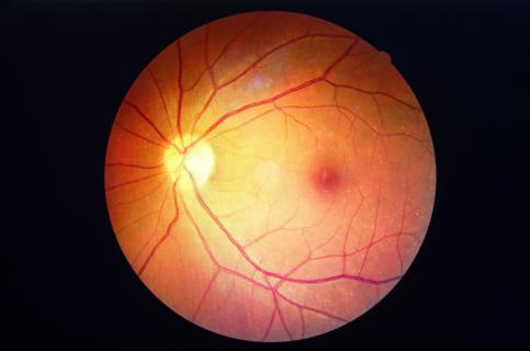 Diabetic Retinopathy: A Serious Complication Of Diabetes logo